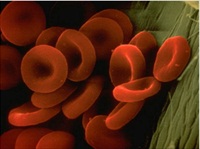 Test kit identifies genetic risk of thrombosis